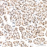 Immunohistochemistry - Anti-REPIN1 Antibody (A329798) - Antibodies.com