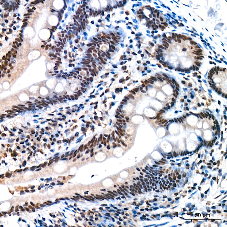 Immunohistochemistry - Anti-REPIN1 Antibody (A329798) - Antibodies.com