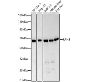 Western Blot - Anti-Ribophorin I Antibody (A329803) - Antibodies.com