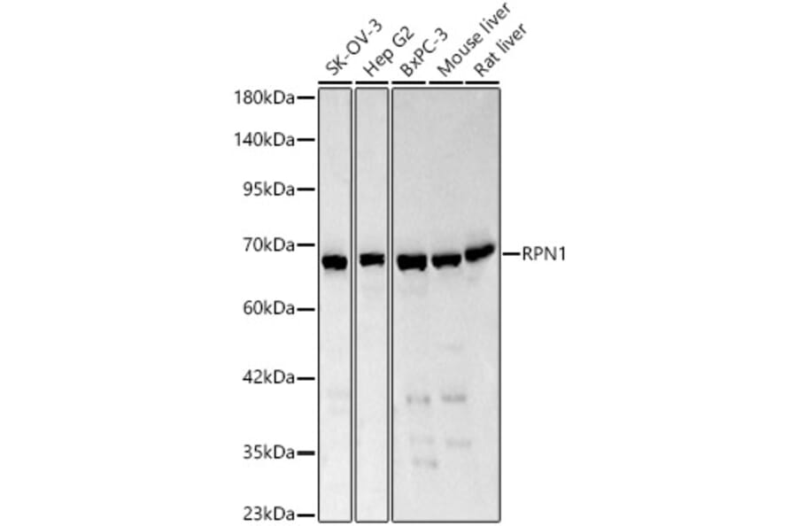 Western Blot - Anti-Ribophorin I Antibody (A329803) - Antibodies.com