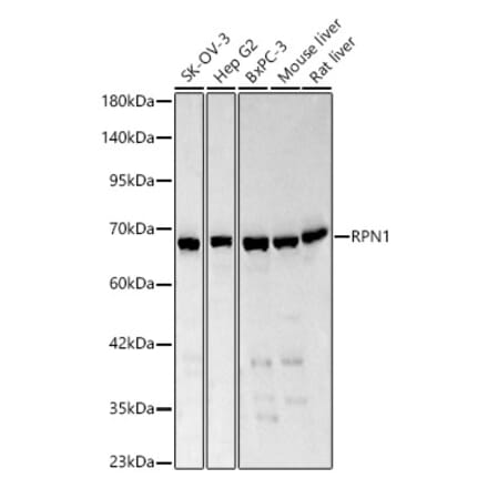 Western Blot - Anti-Ribophorin I Antibody (A329803) - Antibodies.com
