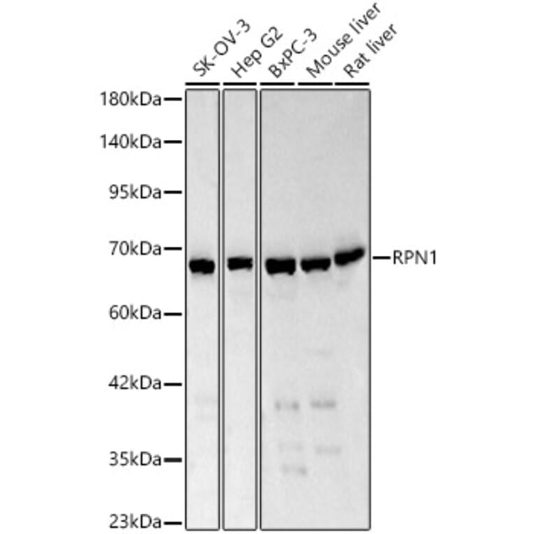 Western Blot - Anti-Ribophorin I Antibody (A329803) - Antibodies.com