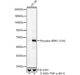 Western Blot - Anti-RIP (Phospho S166) Antibody [ARC62873] (A329804) - Antibodies.com