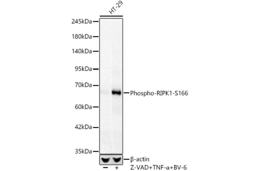 Western Blot - Anti-RIP (Phospho S166) Antibody [ARC62873] (A329804) - Antibodies.com