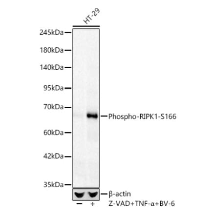 Western Blot - Anti-RIP (Phospho S166) Antibody [ARC62873] (A329804) - Antibodies.com