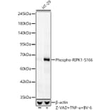Western Blot - Anti-RIP (Phospho S166) Antibody [ARC62873] (A329804) - Antibodies.com