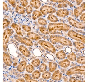 Immunohistochemistry - Anti-RIP3 Antibody (A329805) - Antibodies.com