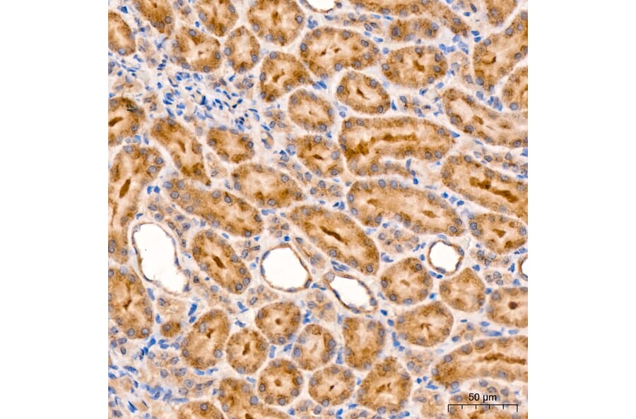 Immunohistochemistry - Anti-RIP3 Antibody (A329805) - Antibodies.com