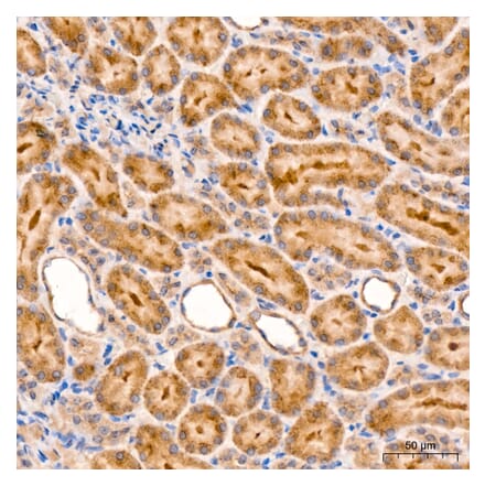 Immunohistochemistry - Anti-RIP3 Antibody (A329805) - Antibodies.com