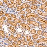 Immunohistochemistry - Anti-RIP3 Antibody (A329805) - Antibodies.com