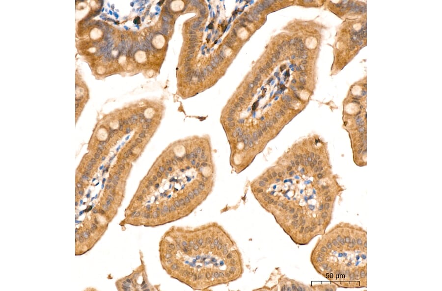 Immunohistochemistry - Anti-RIP3 Antibody (A329805) - Antibodies.com