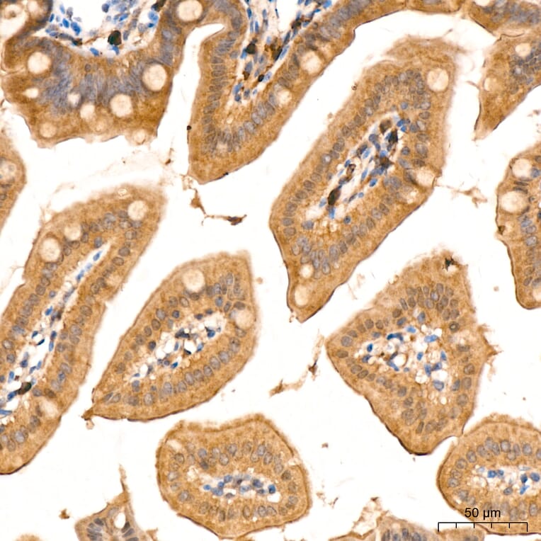 Immunohistochemistry - Anti-RIP3 Antibody (A329805) - Antibodies.com
