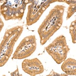 Immunohistochemistry - Anti-RIP3 Antibody (A329805) - Antibodies.com