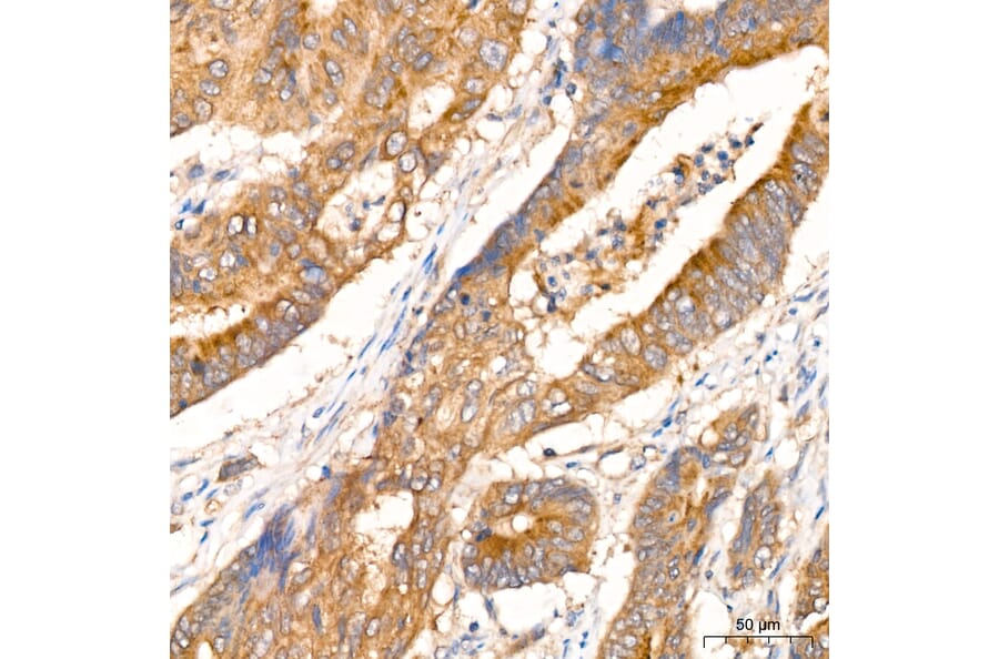Immunohistochemistry - Anti-RIP3 Antibody (A329805) - Antibodies.com