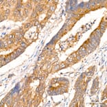 Immunohistochemistry - Anti-RIP3 Antibody (A329805) - Antibodies.com