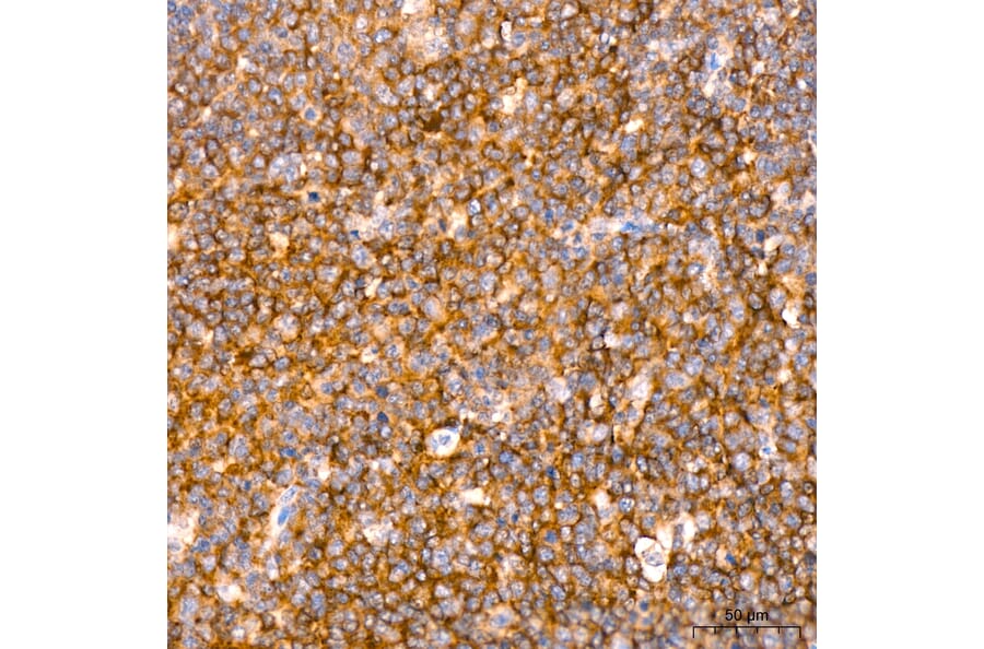 Immunohistochemistry - Anti-RIP3 Antibody (A329805) - Antibodies.com