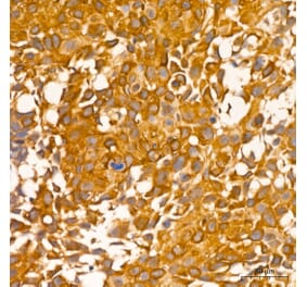 Immunohistochemistry - Anti-RIP3 Antibody (A329806) - Antibodies.com