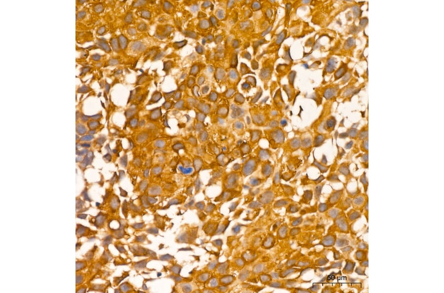 Immunohistochemistry - Anti-RIP3 Antibody (A329806) - Antibodies.com