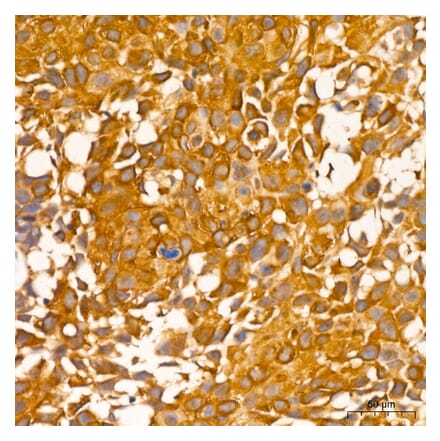 Immunohistochemistry - Anti-RIP3 Antibody (A329806) - Antibodies.com