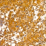 Immunohistochemistry - Anti-RIP3 Antibody (A329806) - Antibodies.com