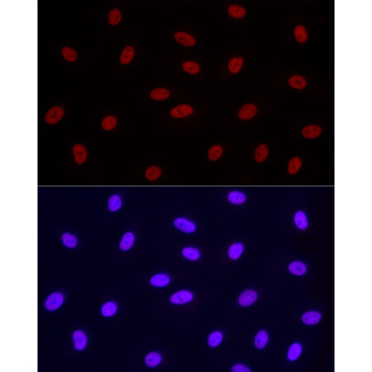 Immunofluorescence - Anti-RNA polymerase II CTD repeat YSPTSPS (Phospho S2) Antibody [ARC1540] (A329807) - Antibodies.com