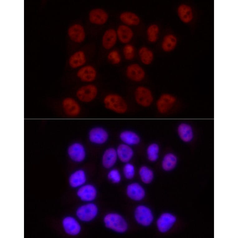 Immunofluorescence - Anti-RNA polymerase II CTD repeat YSPTSPS (Phospho S2) Antibody [ARC1540] (A329807) - Antibodies.com