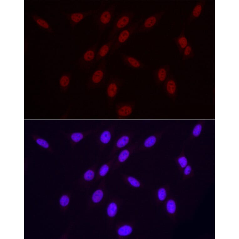 Immunofluorescence - Anti-RNA polymerase II CTD repeat YSPTSPS (Phospho S2) Antibody [ARC1540] (A329807) - Antibodies.com