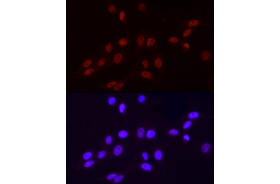 Immunofluorescence - Anti-RNA polymerase II CTD repeat YSPTSPS (Phospho S2) Antibody [ARC1540] (A329807) - Antibodies.com