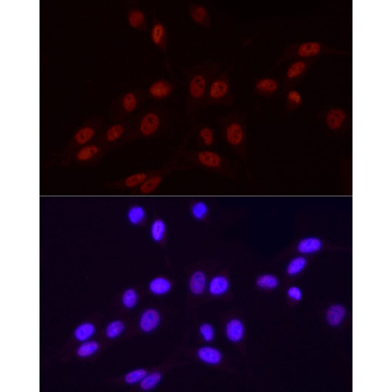 Immunofluorescence - Anti-RNA polymerase II CTD repeat YSPTSPS (Phospho S2) Antibody [ARC1540] (A329807) - Antibodies.com