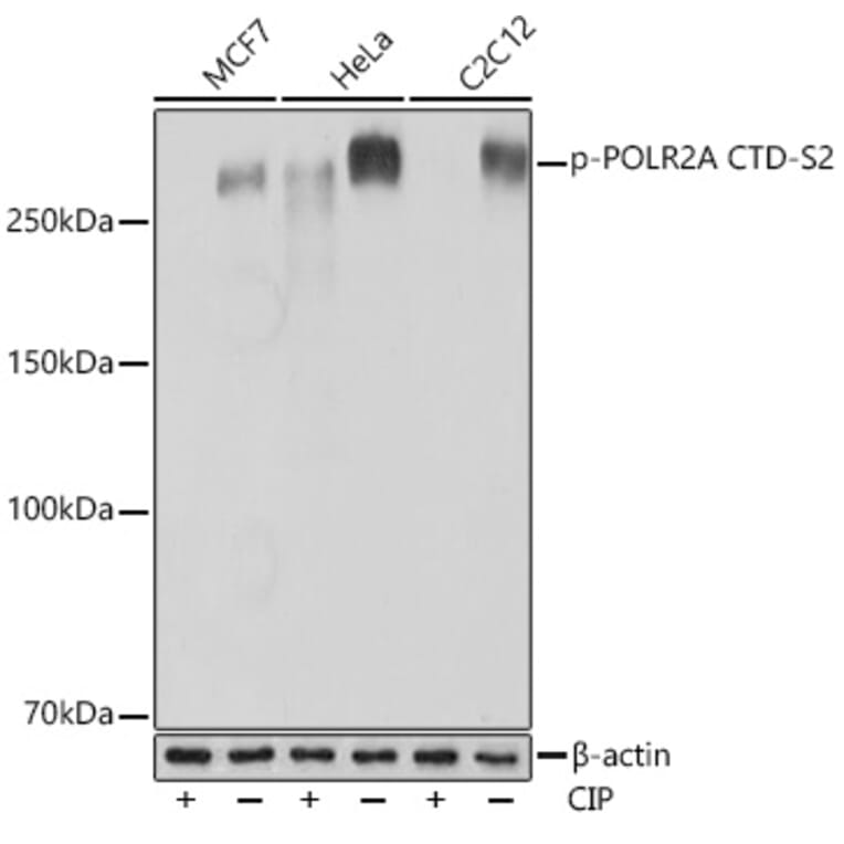 Western Blot - Anti-RNA polymerase II CTD repeat YSPTSPS (Phospho S2) Antibody [ARC1540] (A329807) - Antibodies.com