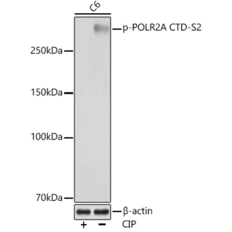 Western Blot - Anti-RNA polymerase II CTD repeat YSPTSPS (Phospho S2) Antibody [ARC1540] (A329807) - Antibodies.com