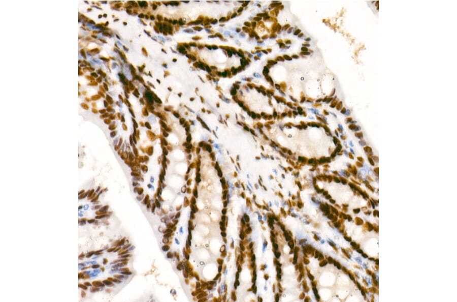 Immunohistochemistry - Anti-RNA polymerase II CTD repeat YSPTSPS (Phospho S2) Antibody [ARC1540] (A329807) - Antibodies.com