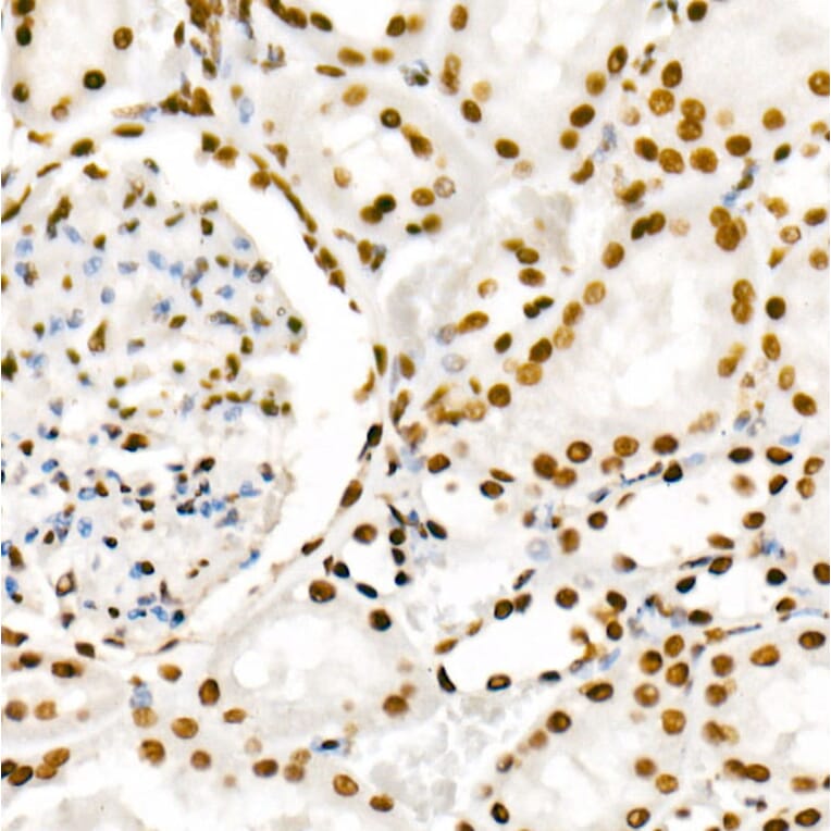 Immunohistochemistry - Anti-RNA polymerase II CTD repeat YSPTSPS (Phospho S2) Antibody [ARC1540] (A329807) - Antibodies.com