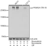 Western Blot - Anti-RNA polymerase II CTD repeat YSPTSPS (Phospho S5) Antibody [ARC1541] (A329808) - Antibodies.com