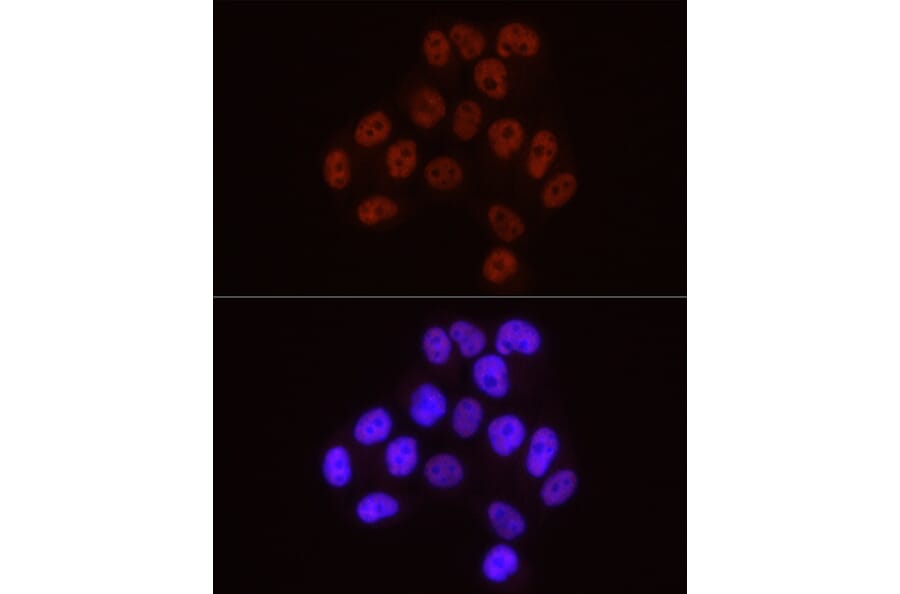 Immunofluorescence - Anti-RNA polymerase II CTD repeat YSPTSPS (Phospho S5) Antibody [ARC1541] (A329808) - Antibodies.com