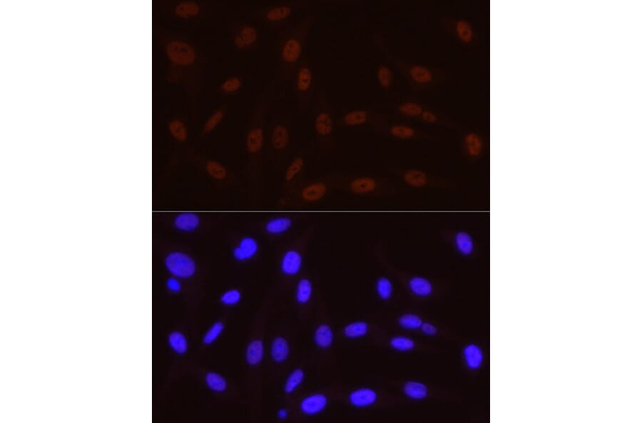Immunofluorescence - Anti-RNA polymerase II CTD repeat YSPTSPS (Phospho S5) Antibody [ARC1541] (A329808) - Antibodies.com