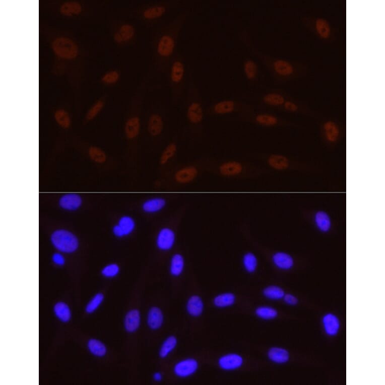 Immunofluorescence - Anti-RNA polymerase II CTD repeat YSPTSPS (Phospho S5) Antibody [ARC1541] (A329808) - Antibodies.com