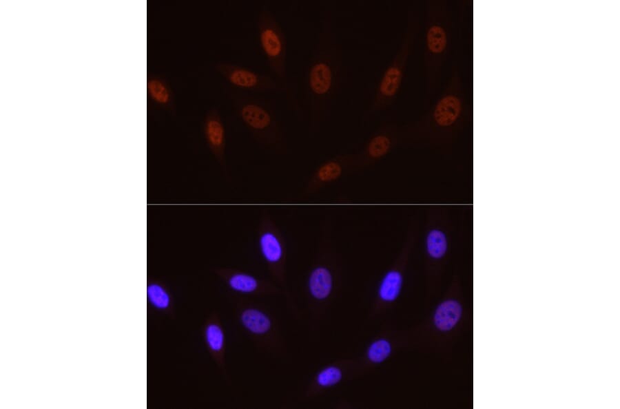Immunofluorescence - Anti-RNA polymerase II CTD repeat YSPTSPS (Phospho S5) Antibody [ARC1541] (A329808) - Antibodies.com