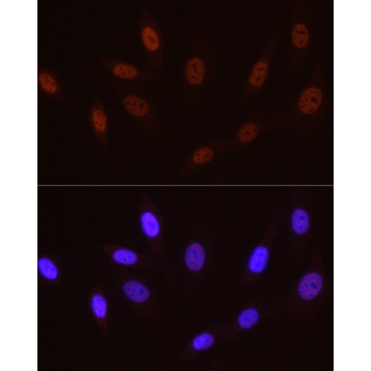 Immunofluorescence - Anti-RNA polymerase II CTD repeat YSPTSPS (Phospho S5) Antibody [ARC1541] (A329808) - Antibodies.com