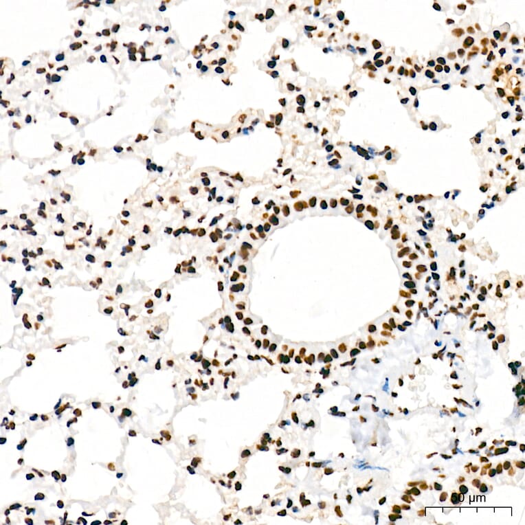 Immunohistochemistry - Anti-RNA polymerase II CTD repeat YSPTSPS (Phospho S5) Antibody [ARC1541] (A329808) - Antibodies.com