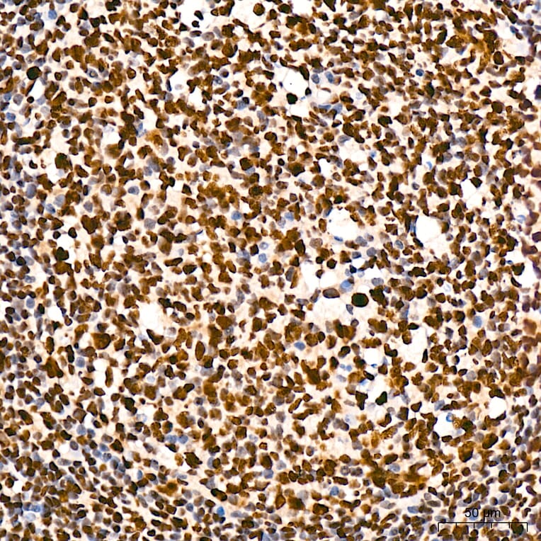 Immunohistochemistry - Anti-RNA polymerase II CTD repeat YSPTSPS (Phospho S5) Antibody [ARC1541] (A329808) - Antibodies.com
