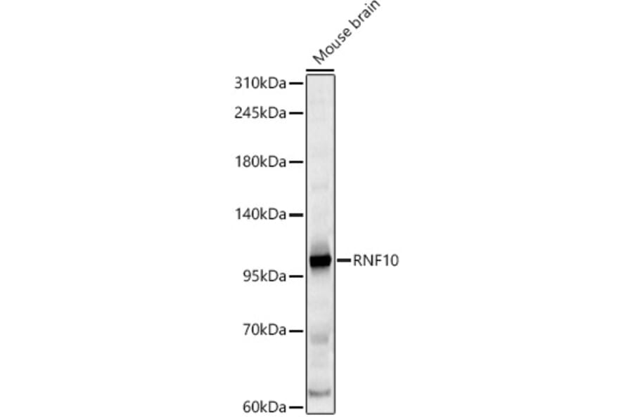 Western Blot - Anti-RNF10 Antibody (A329809) - Antibodies.com