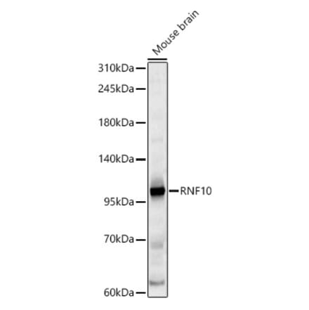 Western Blot - Anti-RNF10 Antibody (A329809) - Antibodies.com