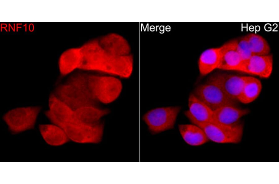 Immunofluorescence - Anti-RNF10 Antibody (A329809) - Antibodies.com
