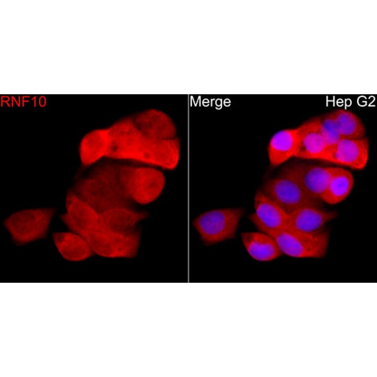 Immunofluorescence - Anti-RNF10 Antibody (A329809) - Antibodies.com