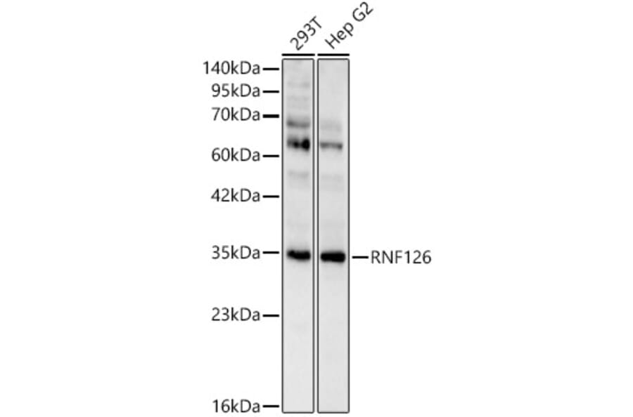 Western Blot - Anti-RNF126 Antibody (A329810) - Antibodies.com