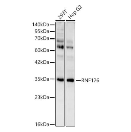 Western Blot - Anti-RNF126 Antibody (A329810) - Antibodies.com