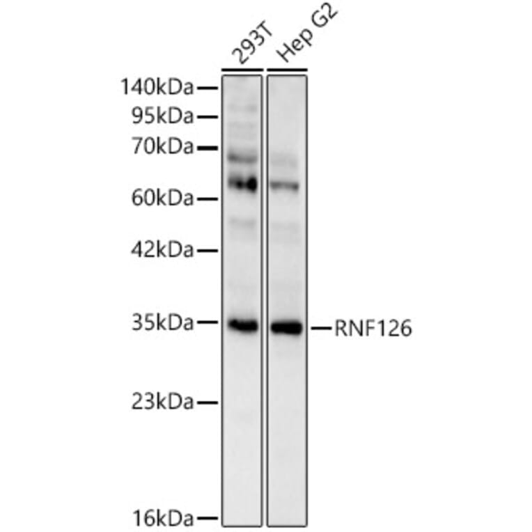 Western Blot - Anti-RNF126 Antibody (A329810) - Antibodies.com