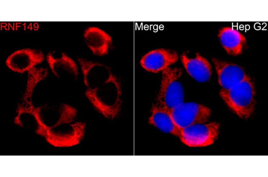 Immunofluorescence - Anti-RNF149 Antibody (A329811) - Antibodies.com