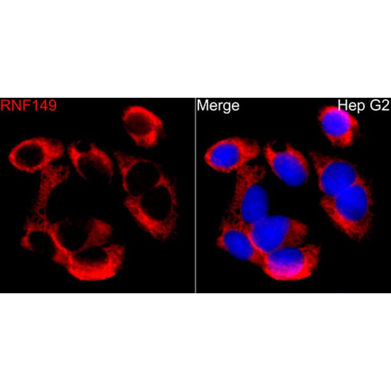 Immunofluorescence - Anti-RNF149 Antibody (A329811) - Antibodies.com